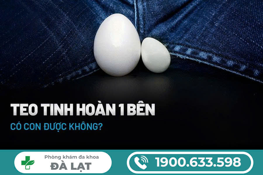 Hình ảnh minh họa